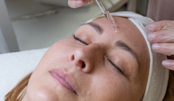 chemicky peeling